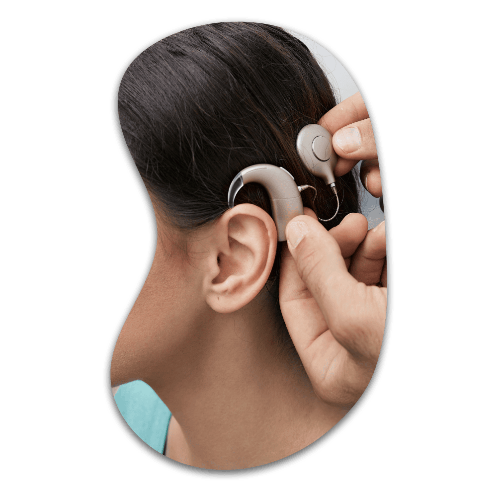 Person inserting a beige behind-the-ear hearing aid into their ear